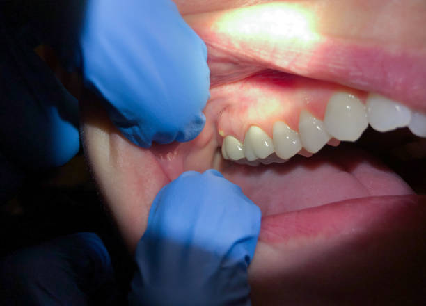 Best Emergency Dentist for Knocked-Out Tooth in Level Park Oak Park, MI